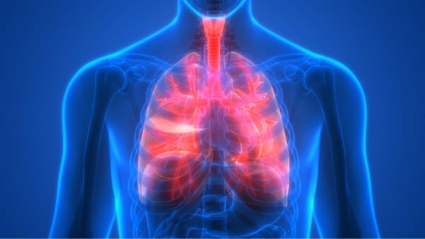 Viêm phổi là một trong những biến chứng nguy hiểm của cúm